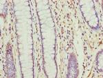 TMEM177 Antibody in Immunohistochemistry (Paraffin) (IHC (P))