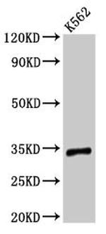 TMEM177 Antibody in Western Blot (WB)