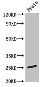 TMEM186 Antibody in Western Blot (WB)