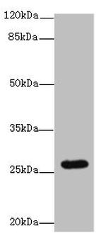 TMEM217 Antibody in Western Blot (WB)