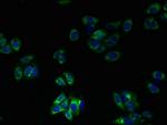TM41A Polyclonal Antibody