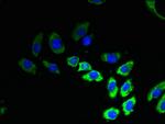 TMEM53 Antibody in Immunocytochemistry (ICC/IF)