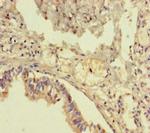 TMEM64 Polyclonal Antibody