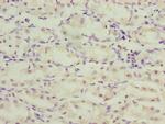 TMEM71 Polyclonal Antibody