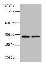 TMEM71 Antibody in Western Blot (WB)