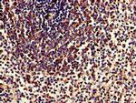 TPD52L2 Antibody in Immunohistochemistry (Paraffin) (IHC (P))