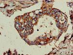 TPD52L2 Antibody in Immunohistochemistry (Paraffin) (IHC (P))