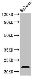 TPD52L2 Antibody in Western Blot (WB)
