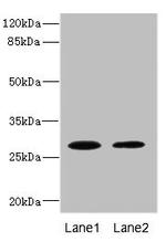 TPK1 Antibody in Western Blot (WB)