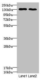 TPP2 Antibody in Western Blot (WB)