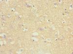 TPPP Polyclonal Antibody