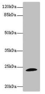 TPPP Antibody in Western Blot (WB)