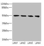 TUBB2A Polyclonal Antibody