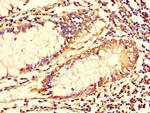 TUBG1 Antibody in Immunohistochemistry (Paraffin) (IHC (P))