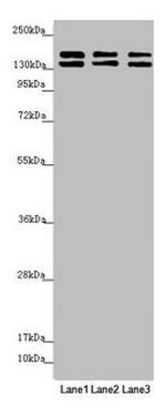 UACA Antibody in Western Blot (WB)