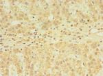YKT6 Antibody in Immunohistochemistry (Paraffin) (IHC (P))