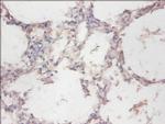 CYB5R3 Antibody in Immunohistochemistry (Paraffin) (IHC (P))