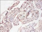 CYB5R3 Antibody in Immunohistochemistry (Paraffin) (IHC (P))