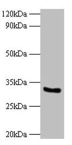 CYB5R3 Antibody in Western Blot (WB)