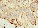 ZNF19 Antibody in Immunohistochemistry (Paraffin) (IHC (P))