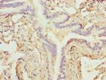 ZNF212 Antibody in Immunohistochemistry (Paraffin) (IHC (P))
