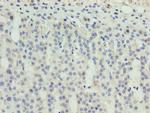 ZNF215 Polyclonal Antibody
