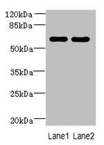 ZNF215 Antibody in Western Blot (WB)