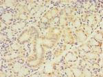ZNF238 Polyclonal Antibody