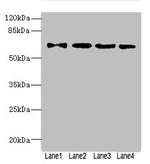 ZNF324 Antibody in Western Blot (WB)