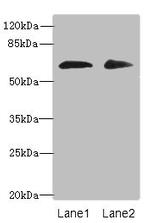 ZNF529 Antibody in Western Blot (WB)