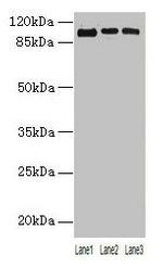 ZNF546 Polyclonal Antibody