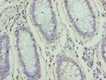 ZNF555 Polyclonal Antibody