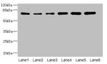 ZNF555 Antibody in Western Blot (WB)