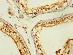 ZNF562 Antibody in Immunohistochemistry (Paraffin) (IHC (P))