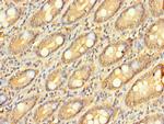 ZNF562 Polyclonal Antibody