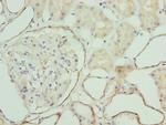 ZNF563 Polyclonal Antibody