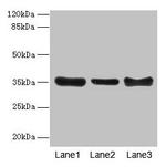 ZNF625 Antibody in Western Blot (WB)