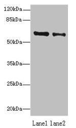 ZNF626 Antibody in Western Blot (WB)