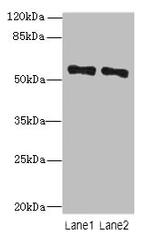 ZNF689 Polyclonal Antibody