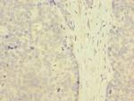 ZNF707 Polyclonal Antibody