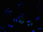 DAD1 Polyclonal Antibody