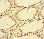 TUBA1B Antibody in Immunohistochemistry (Paraffin) (IHC (P))