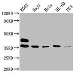 FCGR2A Antibody in Western Blot (WB)