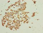 BTBD2 Antibody in Immunohistochemistry (Paraffin) (IHC (P))