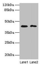 BTBD2 Antibody in Western Blot (WB)