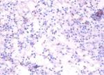 TNFRSF19L Antibody in Immunohistochemistry (Paraffin) (IHC (P))