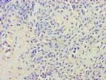 AVP Polyclonal Antibody
