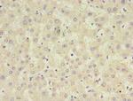 CFHR2 Polyclonal Antibody