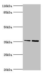CFHR2 Antibody in Western Blot (WB)