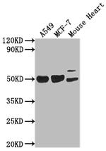 SRGAP2B Antibody in Western Blot (WB)
